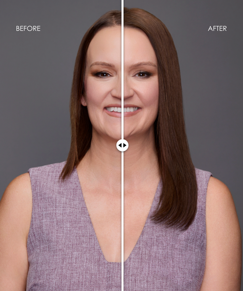 easiPart XL Wide HH 14"